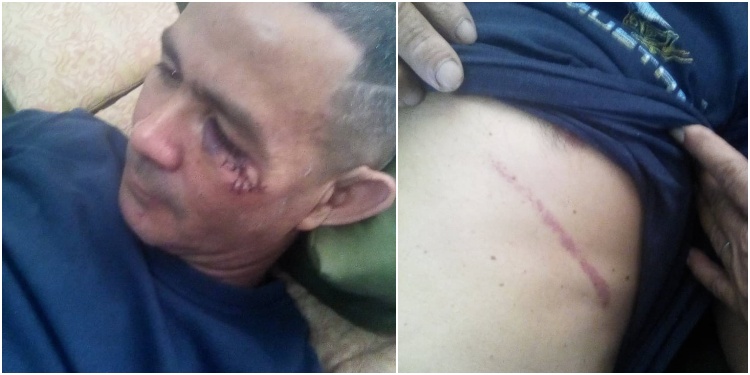 Damián, uno de los manifestantes agredidos por fuerzas policiales, actualmente detenido